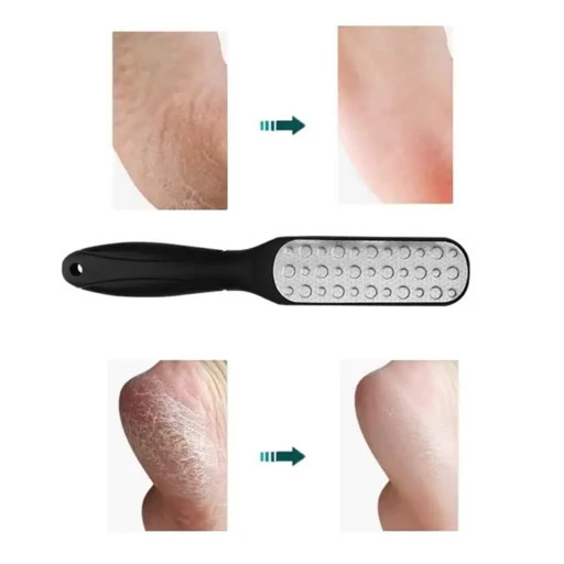 سوهان لیزری کف پا سایز متوسط